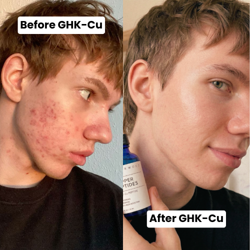 Topical GHK-Cu Serum