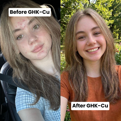 Topical GHK-Cu Serum