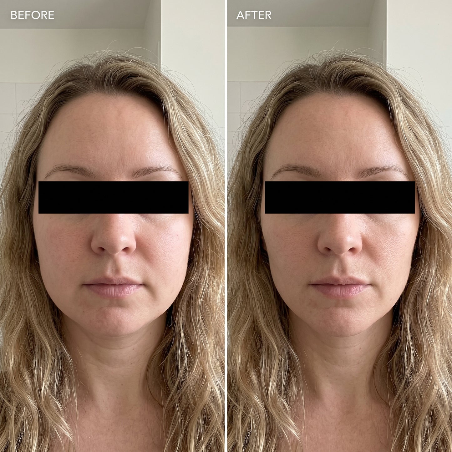 Lymphatic Drainage Drops