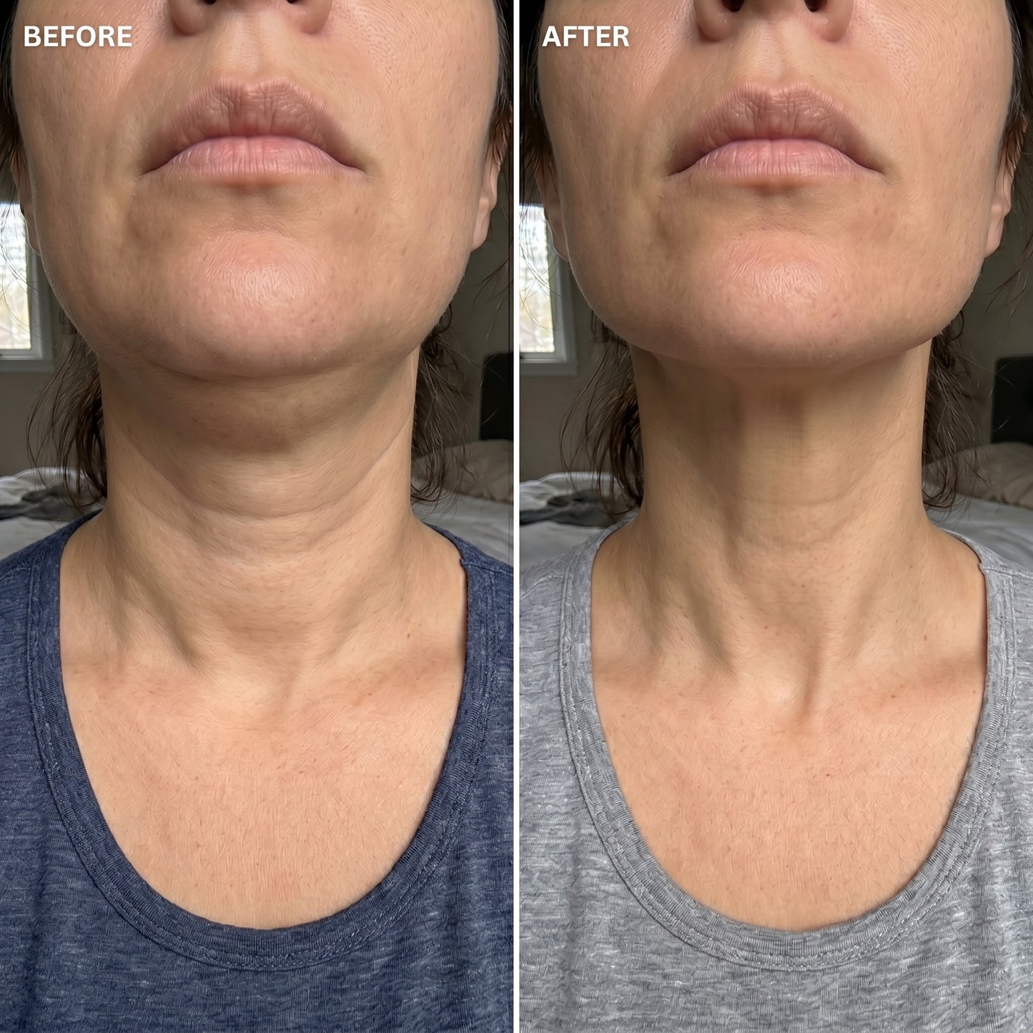 Lymphatic Drainage Drops
