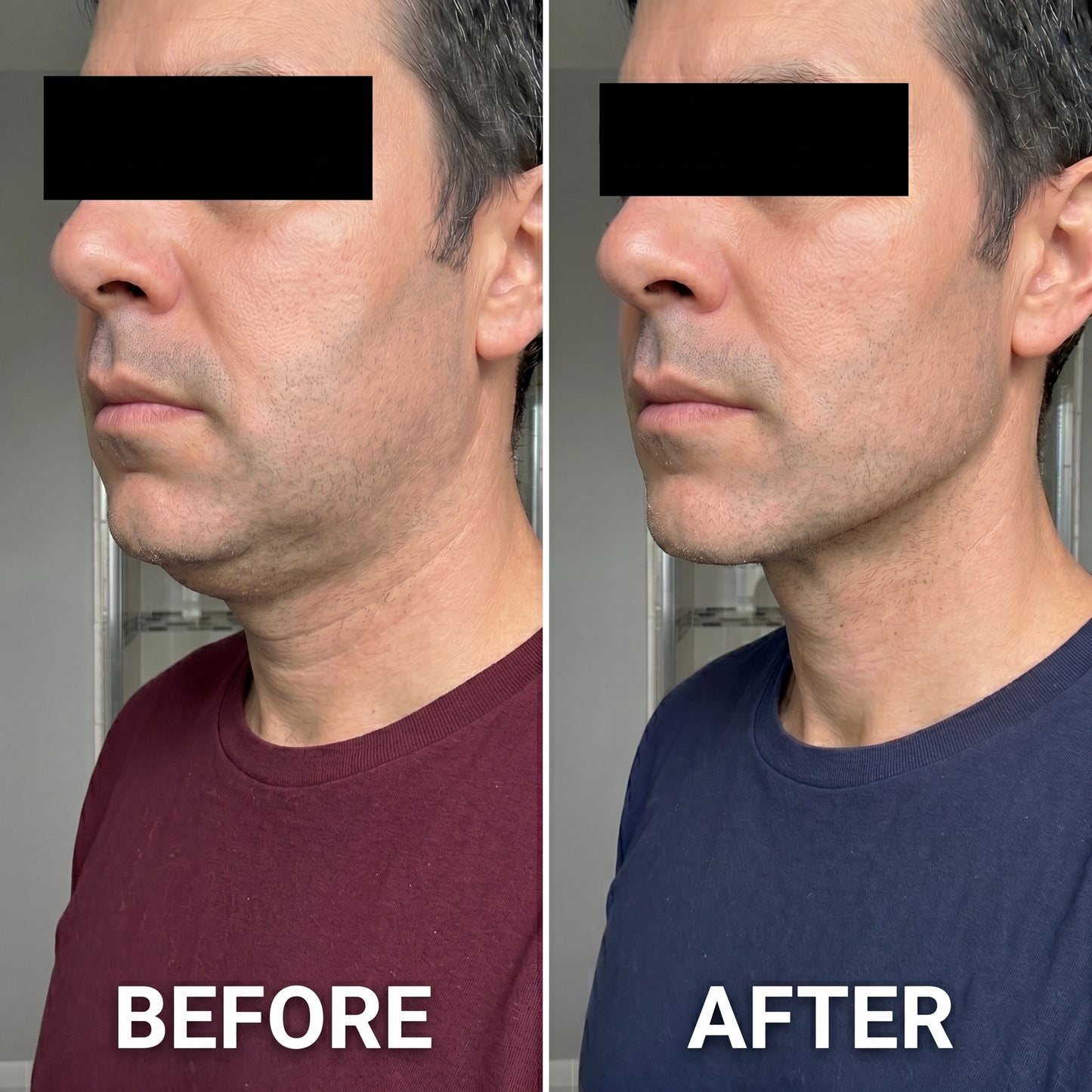 Lymphatic Drainage Drops